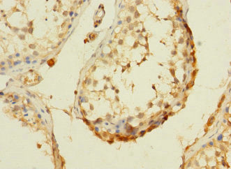 Immunohistochemistry of paraffin-embedded human testis tissue using DHX32 Antibody at dilution of 1:100Rabbit anti-Human DHX32 Polyclonal Antibody