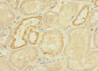 Immunohistochemistry of paraffin-embedded human kidney tissue using DHX32 Antibody at dilution of 1:100Rabbit anti-Human DHX32 Polyclonal Antibody