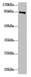 Western Blot  | All lanes: DHX32 antibody at 10µg/ml + Mouse liver tissue  | Secondary  | Goat polyclonal to rabbit IgG at 1/10000 dilution  | Predicted band size: 85, 76 kDa  | Observed band size: 85 kDaRabbit anti-Human DHX32 Polyclonal Antibody