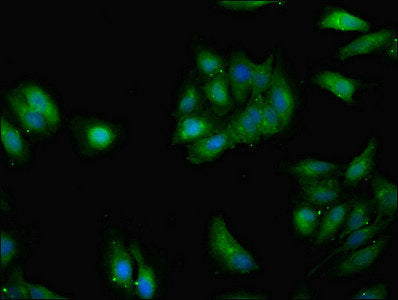 Immunofluorescent analysis of Hela cells using GRHL2 Antibody at dilution of 1:100 and Alexa Fluor 488-congugated AffiniPure Goat Anti-Rabbit IgG(H+L)Rabbit anti-Human GRHL2 Polyclonal Antibody