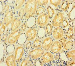 Immunohistochemistry of paraffin-embedded human kidney tissue using the antibody at dilution of 1:100Rabbit anti-Human GRHL2 Polyclonal Antibody