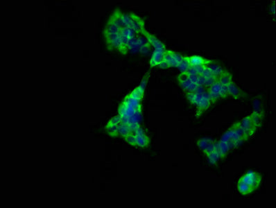 Immunofluorescence staining of 293 cells with CD300LG Antibody at 1:66, counter-stained with DAPI. The cells were fixed in 4% formaldehyde, permeabilized using 0.2% Triton X-100 and blocked in 10% normal Goat Serum. The cells were then incubated with the antibody overnight at 4°C. The secondary antibody was Alexa Fluor 488-congugated AffiniPure Goat Anti-Rabbit IgG(H+L).Rabbit anti-Human CD300LG Polyclonal Antibody