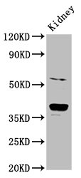 Western Blot | Positive WB detected in: Rat kidney tissue | All lanes: CD300LG antibody at 6μg/ml | Secondary | Goat polyclonal to rabbit IgG at 1/50000 dilution | Predicted band size: 37, 27, 25, 34, 30 kDa | Observed band size: 37 kDaRabbit anti-Human CD300LG Polyclonal Antibody