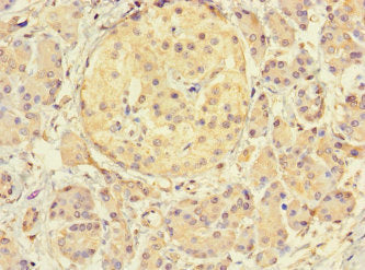 Immunohistochemistry of paraffin-embedded human pancreatic tissue using THADA Antibody at dilution of 1:100Rabbit anti-Human THADA Polyclonal Antibody