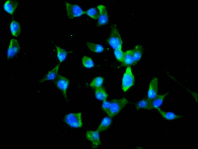 Immunofluorescence staining of SH-SY5Y cells with MEX3B Antibody at 1:100, counter-stained with DAPI. The cells were fixed in 4% formaldehyde, permeabilized using 0.2% Triton X-100 and blocked in 10% normal Goat Serum. The cells were then incubated with the antibody overnight at 4°C. The secondary antibody was Alexa Fluor 488-congugated AffiniPure Goat Anti-Rabbit IgG(H+L).