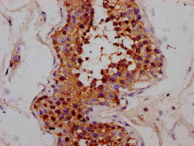 IHC image of the antibody diluted at 1:300 and staining in paraffin-embedded human testis tissue performed on a Leica BondTM system. After dewaxing and hydration, antigen retrieval was mediated by high pressure in a citrate buffer (pH 6.0). Section was blocked with 10% normal goat serum 30min at RT. Then primary antibody (1% BSA) was incubated at 4°C overnight. The primary is detected by a biotinylated secondary antibody and visualized using an HRP conjugated SP system.