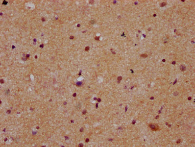 IHC image of MEX3B Antibody diluted at 1:300 and staining in paraffin-embedded human brain tissue performed on a Leica BondTM system. After dewaxing and hydration, antigen retrieval was mediated by high pressure in a citrate buffer (pH 6.0). Section was blocked with 10% normal goat serum 30min at RT. Then primary antibody (1% BSA) was incubated at 4°C overnight. The primary is detected by a biotinylated secondary antibody and visualized using an HRP conjugated SP system.