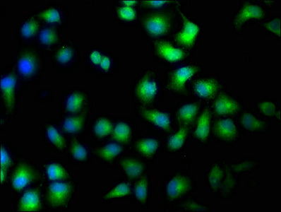 Immunofluorescence staining of Hela cells with TAOK1 Antibody at 1:100, counter-stained with DAPI. The cells were fixed in 4% formaldehyde, permeabilized using 0.2% Triton X-100 and blocked in 10% normal Goat Serum. The cells were then incubated with the antibody overnight at 4°C. The secondary antibody was Alexa Fluor 488-congugated AffiniPure Goat Anti-Rabbit IgG(H+L).Rabbit anti-Human TAOK1 Polyclonal Antibody