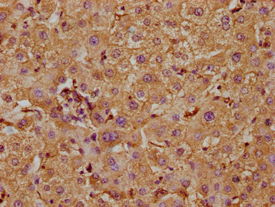 IHC image of the antibody diluted at 1:300 and staining in paraffin-embedded human liver tissue performed on a Leica BondTM system. After dewaxing and hydration, antigen retrieval was mediated by high pressure in a citrate buffer (pH 6.0). Section was blocked with 10% normal goat serum 30min at RT. Then primary antibody (1% BSA) was incubated at 4°C overnight. The primary is detected by a biotinylated secondary antibody and visualized using an HRP conjugated SP system.Rabbit anti-Human TAOK1 Polyclonal Antibody