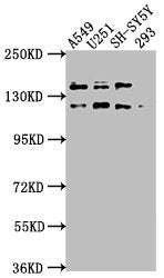 Western Blot | Positive WB detected in: A549 whole cell lysate, U251 whole cell lysate, SH-SY5Y whole cell lysate, 293 whole cell lysate | All lanes: TAOK1 antibody at 1:2000 | Secondary | Goat polyclonal to rabbit IgG at 1/50000 dilution | Predicted band size: 117, 47, 98 kDa | Observed band size: 117 kDaRabbit anti-Human TAOK1 Polyclonal Antibody