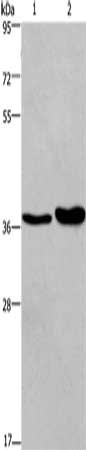 Gel: 8%SDS-PAGE, Lysate: 40 μg, Lane 1-2: Human testis tissue, Human transitional cell carcinoma of bladder tissue, Primary antibody: FUT1 Antibody(FUT1 Antibody) at dilution 1/250, Secondary antibody: Goat anti rabbit IgG at 1/8000 dilution, Exposure time: 20 secondsRabbit anti-Human FUT1 Polyclonal Antibody