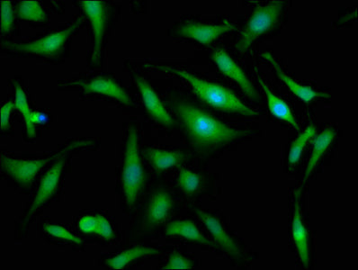 Immunofluorescence staining of Hela cells with OTUD7B Antibody at 1:133, counter-stained with DAPI. The cells were fixed in 4% formaldehyde, permeabilized using 0.2% Triton X-100 and blocked in 10% normal Goat Serum. The cells were then incubated with the antibody overnight at 4°C. The secondary antibody was Alexa Fluor 488-congugated AffiniPure Goat Anti-Rabbit IgG(H+L).Rabbit anti-Human OTUD7B Polyclonal Antibody