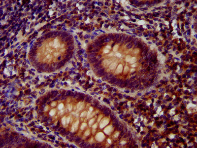 IHC image of the antibody diluted at 1:400 and staining in paraffin-embedded human appendix tissue performed on a Leica BondTM system. After dewaxing and hydration, antigen retrieval was mediated by high pressure in a citrate buffer (pH 6.0). Section was blocked with 10% normal goat serum 30min at RT. Then primary antibody (1% BSA) was incubated at 4°C overnight. The primary is detected by a biotinylated secondary antibody and visualized using an HRP conjugated SP system.Rabbit anti-Human OTUD7B Polyclonal Antibody