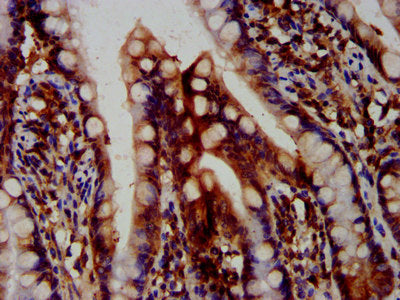 IHC image of OTUD7B Antibody diluted at 1:400 and staining in paraffin-embedded human small intestine tissue performed on a Leica BondTM system. After dewaxing and hydration, antigen retrieval was mediated by high pressure in a citrate buffer (pH 6.0). Section was blocked with 10% normal goat serum 30min at RT. Then primary antibody (1% BSA) was incubated at 4°C overnight. The primary is detected by a biotinylated secondary antibody and visualized using an HRP conjugated SP system.Rabbit anti-Human OTUD7B Polyclonal Antibody