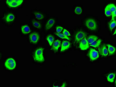 Immunofluorescent analysis of MCF-7 cells using REEP3 Antibody at dilution of 1:100 and Alexa Fluor 488-congugated AffiniPure Goat Anti-Rabbit IgG(H+L)Rabbit anti-Human REEP3 Polyclonal Antibody