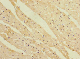 Immunohistochemistry of paraffin-embedded human heart tissue using REEP3 Antibody at dilution of 1:100Rabbit anti-Human REEP3 Polyclonal Antibody