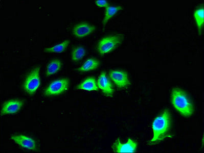 Immunofluorescent analysis of A549 cells using CNIH2 Antibody at dilution of 1:100 and Alexa Fluor 488-congugated AffiniPure Goat Anti-Rabbit IgG(H+L)Rabbit anti-Human CNIH2 Polyclonal Antibody