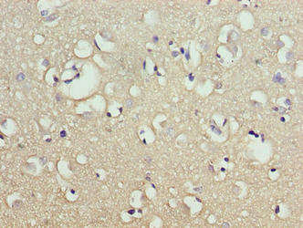 Immunohistochemistry of paraffin-embedded human brain tissue using CNIH2 Antibody at dilution of 1:100Rabbit anti-Human CNIH2 Polyclonal Antibody