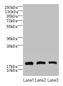 Western blot  | All lanes: CNIH2 antibody at 2µg/ml  | Lane 1: U251 whole cell lysate  | Lane 2: Mouse liver tissue  | Lane 3: Mouse kidney tissue  | Secondary  | Goat polyclonal to rabbit IgG at 1/10000 dilution  | Predicted band size: 19 kDa  | Observed band size: 19 kDaRabbit anti-Human CNIH2 Polyclonal Antibody
