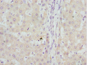 Immunohistochemistry of paraffin-embedded human liver tissue using GBE1 Antibody at dilution of 1:100Rabbit anti-Human GBE1 Polyclonal Antibody