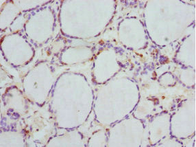 Immunohistochemistry of paraffin-embedded human thyroid tissue using GBE1 Antibody at dilution of 1:100Rabbit anti-Human GBE1 Polyclonal Antibody