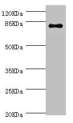 Western blot | All lanes: GBE1 antibody at 3.13μg/ml + Mouse liver tissue | Secondary | Goat polyclonal to rabbit IgG at 1/10000 dilution | predicted band size 80 kDa | Observed band size: 80 kDaRabbit anti-Human GBE1 Polyclonal Antibody
