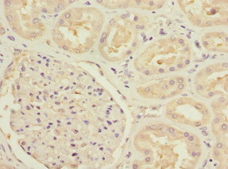 Immunohistochemistry of paraffin-embedded human kidney tissue using MTHFD1L Antibody at dilution of 1:100Rabbit anti-Human MTHFD1L Polyclonal Antibody
