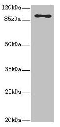 Western blot  | All lanes: MTHFD1L antibody at 3.68µg/ml + Hela whole cell lysate  | Secondary  | Goat polyclonal to rabbit IgG at 1/10000 dilution  | Predicted band size: 106, 30 kDa  | Observed band size: 106 kDaRabbit anti-Human MTHFD1L Polyclonal Antibody