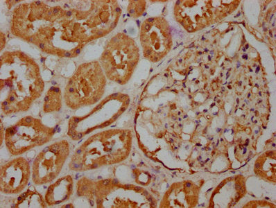 IHC image of RASSF6 Antibody diluted at 1:263 and staining in paraffin-embedded human kidney tissue performed on a Leica BondTM system. After dewaxing and hydration, antigen retrieval was mediated by high pressure in a citrate buffer (pH 6.0). Section was blocked with 10% normal goat serum 30min at RT. Then primary antibody (1% BSA) was incubated at 4°C overnight. The primary is detected by a biotinylated secondary antibody and visualized using an HRP conjugated SP system.Rabbit anti-Human RASSF6 Polyclonal Antibody