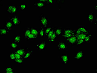 Immunofluorescent analysis of HepG2 cells using ACAD11 Antibody at dilution of 1:100 and Alexa Fluor 488-congugated AffiniPure Goat Anti-Rabbit IgG(H+L)
