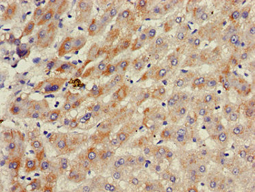 Immunohistochemistry of paraffin-embedded human liver tissue using the antibody at dilution of 1:100