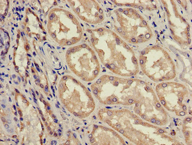 Immunohistochemistry of paraffin-embedded human kidney tissue using ACAD11 Antibody at dilution of 1:100