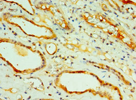 Immunohistochemistry of paraffin-embedded human kidney tissue using CREB3L2 Antibody at dilution of 1:100Rabbit anti-Human CREB3L2 Polyclonal Antibody