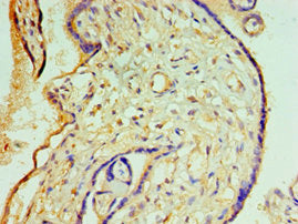 Immunohistochemistry of paraffin-embedded human placenta tissue using CREB3L2 Antibody at dilution of 1:100Rabbit anti-Human CREB3L2 Polyclonal Antibody
