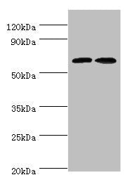 Western blot | All lanes: CREB3L2 antibody at 6μg/ml | Lane 1: Mouse liver tissue | Lane 2: Mouse lung tissue | Secondary | Goat polyclonal to rabbit IgG at 1/10000 dilution | Predicted band size: 58, 51, 28 kDa | Observed band size: 58 kDaRabbit anti-Human CREB3L2 Polyclonal Antibody