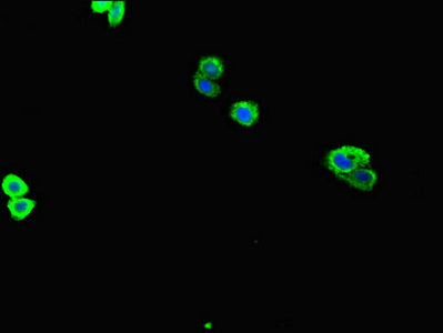 Immunofluorescent analysis of HepG2 cells using ZNF365 Antibody at dilution of 1:100 and Alexa Fluor 488-congugated AffiniPure Goat Anti-Rabbit IgG(H+L)Rabbit anti-Human ZNF365 Polyclonal Antibody