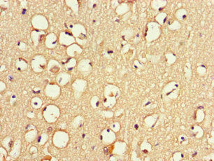 Immunohistochemistry of paraffin-embedded human brain tissue using the antibody at dilution of 1:100Rabbit anti-Human ZNF365 Polyclonal Antibody