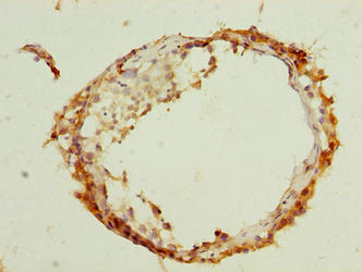 Immunohistochemistry of paraffin-embedded human testis tissue using ARMCX2 Antibody at dilution of 1:100Rabbit anti-Human ARMCX2 Polyclonal Antibody