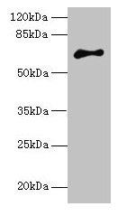Western blot  | All lanes: ARMCX2 antibody at 5µg/ml + MCF-7 whole cell lysate  | Secondary  | Goat polyclonal to rabbit IgG at 1/10000 dilution  | Predicted band size: 66 kDa  | Observed band size: 66 kDaRabbit anti-Human ARMCX2 Polyclonal Antibody