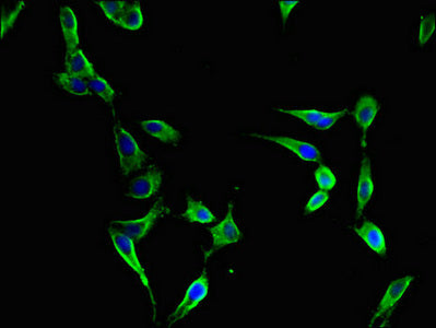 Immunofluorescent analysis of Hela cells using FBXL22 Antibody at dilution of 1:100 and Alexa Fluor 488-congugated AffiniPure Goat Anti-Rabbit IgG(H+L)Rabbit anti-Human FBXL22 Polyclonal Antibody