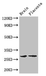 Western Blot | Positive WB detected in: Mouse brain tissue, Human placenta tissue | All lanes: FBXL22 antibody at 3μg/ml | Secondary | Goat polyclonal to rabbit IgG at 1/50000 dilution | Predicted band size: 28 kDa | Observed band size: 28 kDaRabbit anti-Human FBXL22 Polyclonal Antibody