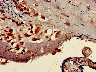 Immunohistochemistry of paraffin-embedded human placenta tissue using TTC27 Antibody at dilution of 1:100Rabbit anti-Human TTC27 Polyclonal Antibody