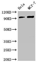 Western Blot | Positive WB detected in: Hela whole cell lysate, MCF-7 whole cell lysate | All lanes: TTC27 antibody at 2.7μg/ml | Secondary | Goat polyclonal to rabbit IgG at 1/50000 dilution | Predicted band size: 97 kDa | Observed band size: 97 kDaRabbit anti-Human TTC27 Polyclonal Antibody
