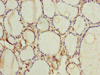 Immunohistochemistry of paraffin-embedded human thyroid tissue using FOXR2 Antibody at dilution of 1:100Rabbit anti-Human FOXR2 Polyclonal Antibody