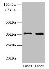 Western blot  | All lanes: FOXR2 antibody at 4µg/ml  | Lane 1: SH-SY5Y whole cell lysate  | Lane 2: Hela whole cell lysate  | Secondary  | Goat polyclonal to rabbit IgG at 1/10000 dilution  | Predicted band size: 36 kDa  | Observed band size: 36 kDaRabbit anti-Human FOXR2 Polyclonal Antibody