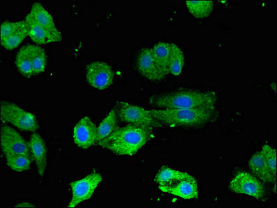 Immunofluorescent analysis of HepG2 cells using CRTC1 Antibody at dilution of 1:100 and Alexa Fluor 488-congugated AffiniPure Goat Anti-Rabbit IgG(H+L)Rabbit anti-Human CRTC1 Polyclonal Antibody