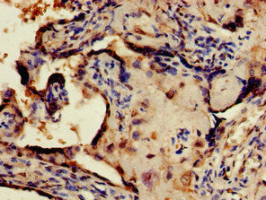 Immunohistochemistry of paraffin-embedded human placenta tissue using the antibody at dilution of 1:100Rabbit anti-Human CRTC1 Polyclonal Antibody