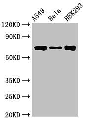 Western Blot  | Positive WB detected in: A549 whole cell lysate, Hela whole cell lysate, HEK293 whole cell lysate  | All lanes: CRTC1 antibody at 3.5µg/ml  | Secondary  | Goat polyclonal to rabbit IgG at 1/50000 dilution  | Predicted band size: 68, 69, 63 kDa  | Observed band size: 68 kDaRabbit anti-Human CRTC1 Polyclonal Antibody