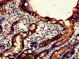 Immunohistochemistry of paraffin-embedded human small intestine tissue using NPSR1 Antibody at dilution of 1:100Rabbit anti-Human NPSR1 Polyclonal Antibody
