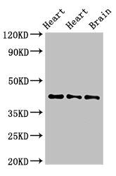 Western Blot | Positive WB detected in: Rat heart tissue, Mouse heart tissue, Mouse brain tissue | All lanes: NPSR1 antibody at 4μg/ml | Secondary | Goat polyclonal to rabbit IgG at 1/50000 dilution | Predicted band size: 43, 36, 45, 44, 42, 19, 16, 17, 11 kDa | Observed band size: 43 kDaRabbit anti-Human NPSR1 Polyclonal Antibody